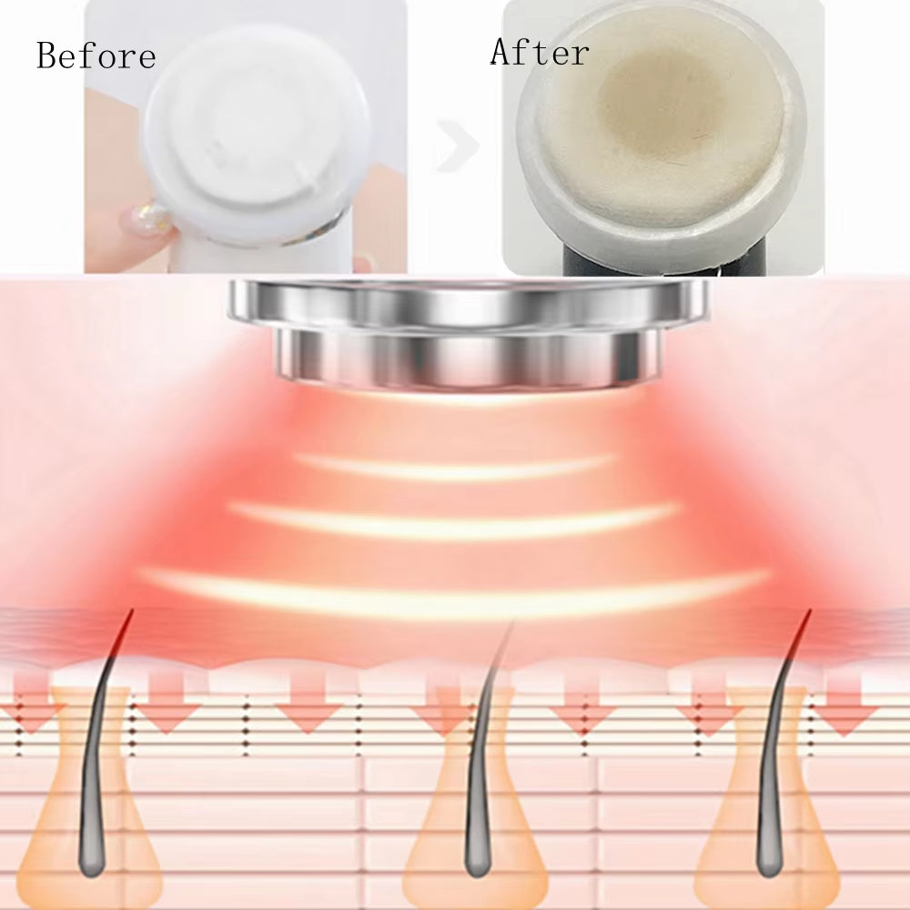 Skin Rejuvenation Face Lifting Wrinkle Removal Face Massager FR Mesotherapy Electroporation Radio Frequency LED Photon Skin Care